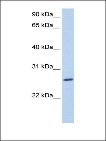 Anti-ZNF664 (AB3) antibody produced in rabbit