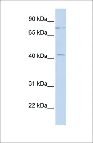 Anti-ZNF302 antibody produced in rabbit