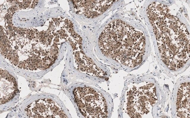 Anti-EZHIP/CXorf67 Antibody, clone 1J8 ZooMAb<sup>®</sup> Rabbit Monoclonal