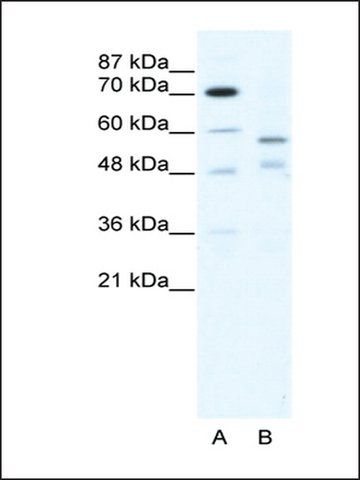 Anti-TRIM23 antibody produced in rabbit