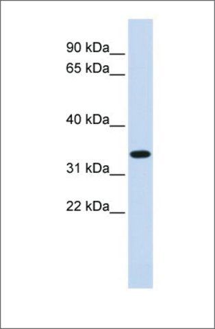 Anti-TRIM14 antibody produced in rabbit