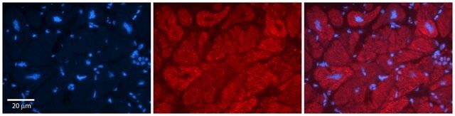 Anti-TRIM15 antibody produced in rabbit