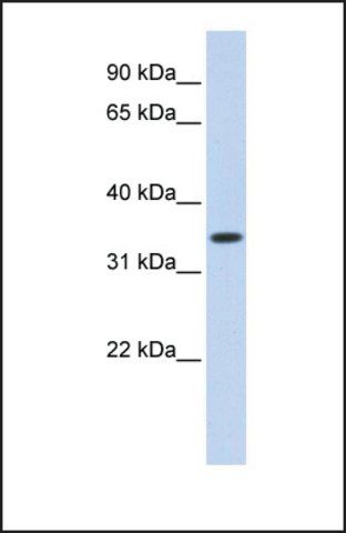 Anti-TRIM27 antibody produced in rabbit