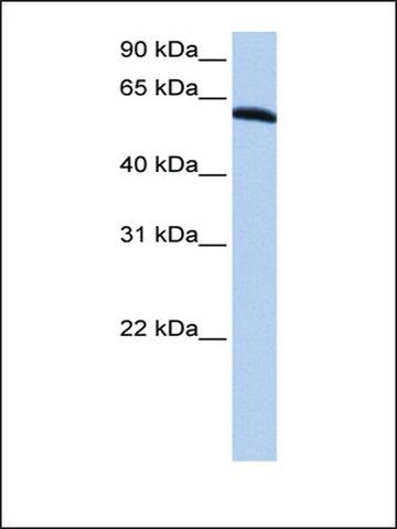 Anti-TRIP6 (AB1) antibody produced in rabbit