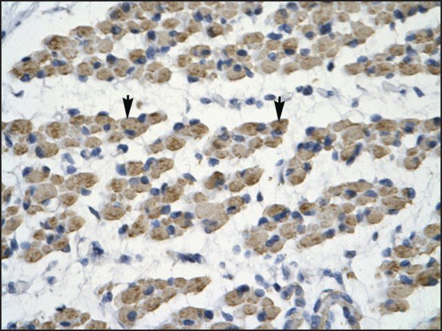 Anti-TRIM68 (AB2) antibody produced in rabbit