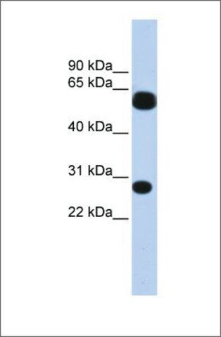 Anti-TRIM16 (ab2) antibody produced in rabbit