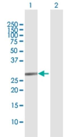 Anti-TRIM72 antibody produced in rabbit