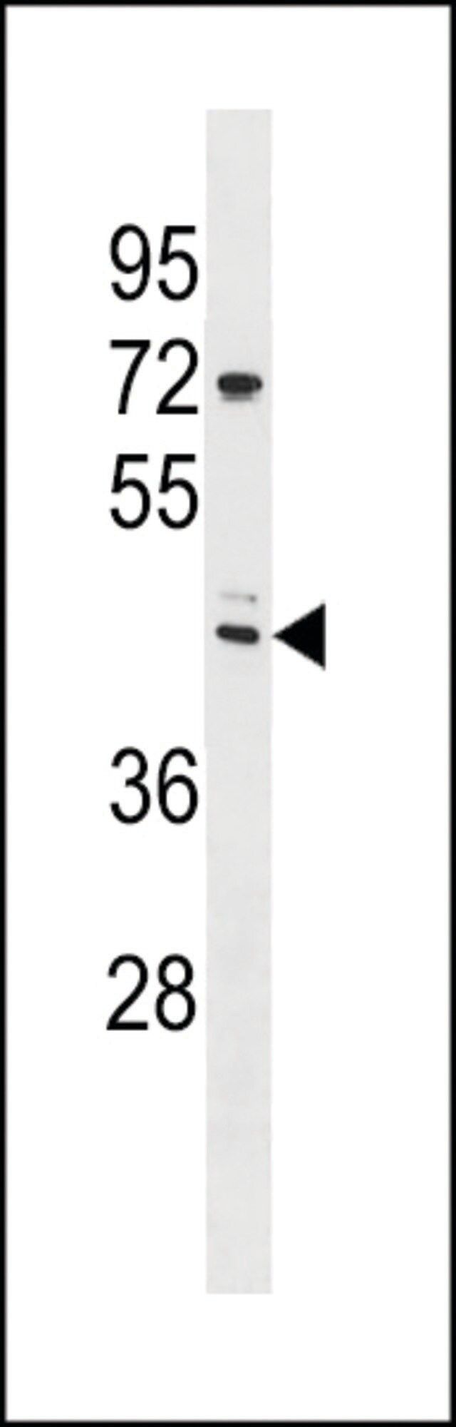 ANTI-TRIX3(N-TERMINAL) antibody produced in rabbit