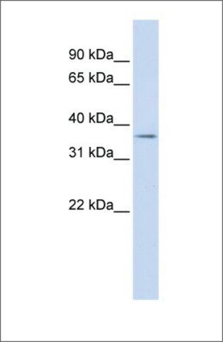 Anti-TRIM69 antibody produced in rabbit