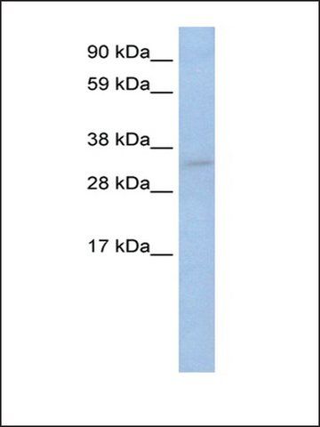 Anti-TRP53 antibody produced in rabbit