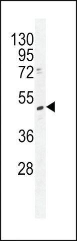 ANTI-TRMT2B(N-TERMINAL) antibody produced in rabbit