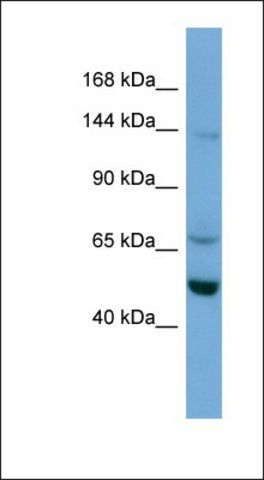 Anti-TRIM66 antibody produced in rabbit