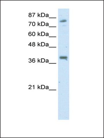 Anti-TSC22D2 antibody produced in rabbit