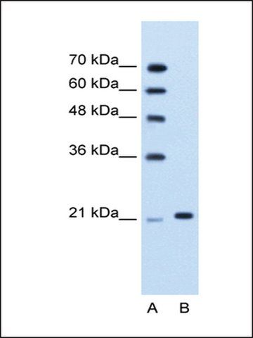 Anti-TRIM26 antibody produced in rabbit