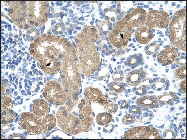 Anti-TRNT1 antibody produced in rabbit