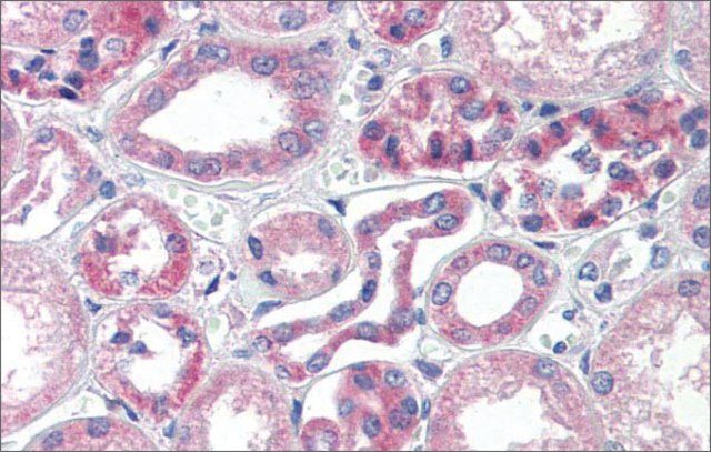 Anti-TRIM68 antibody produced in rabbit