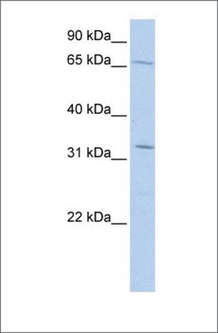 Anti-TRIM22 antibody produced in rabbit