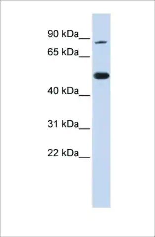 Anti-TRMT1 antibody produced in rabbit