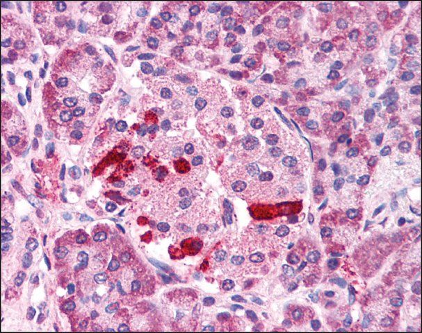 Anti-TRPM4 antibody produced in rabbit