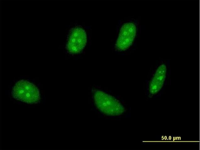 ANTI-TSC22D4 antibody produced in mouse