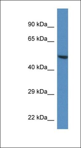 Anti-TRIM11 antibody produced in rabbit