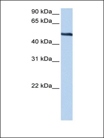 Anti-TRIP6 (AB2) antibody produced in rabbit