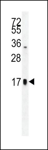 ANTI-TSH-ALPHA(C-TERMINAL) antibody produced in rabbit