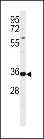 ANTI-TRNAU1AP (CENTER) antibody produced in rabbit