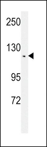 ANTI-TSH2 (N-TERMINAL) antibody produced in rabbit