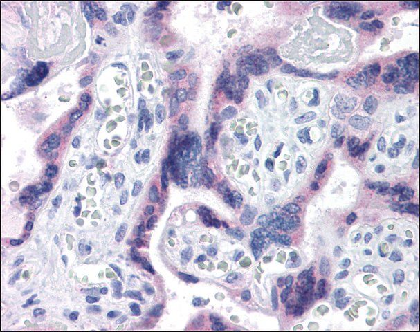 Anti-TTBK2 antibody produced in rabbit