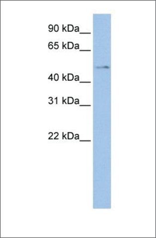 Anti-TSPYL4 antibody produced in rabbit