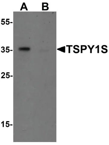 Anti-TSPY1S antibody produced in rabbit