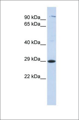 Anti-TSPAN2 antibody produced in rabbit