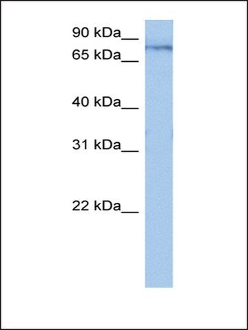 Anti-TTC14 antibody produced in rabbit