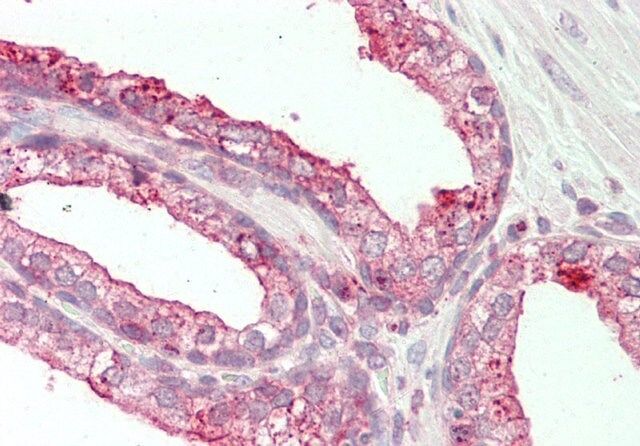 Anti-TSPAN1 antibody produced in rabbit