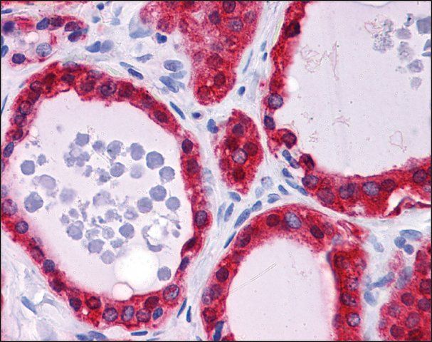 Anti-TSPAN9 antibody produced in rabbit