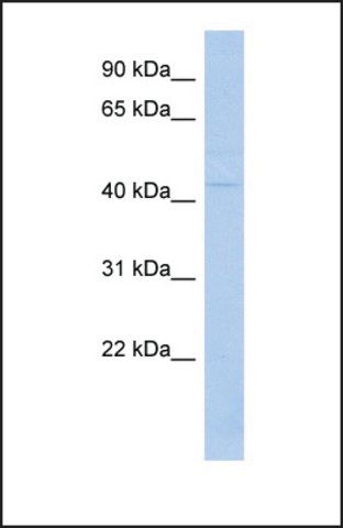 Anti-TSPYL6, (N-terminal) antibody produced in rabbit