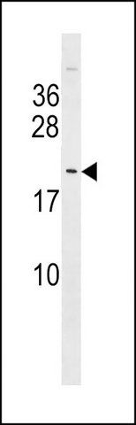 ANTI-TTDN1 (C-TERM) antibody produced in rabbit