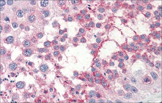 Anti-TSKS (AB1) antibody produced in rabbit