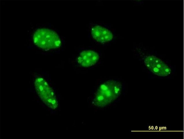 Anti-TSPYL1 antibody produced in mouse