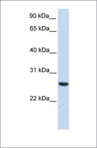 Anti-TTC33 antibody produced in rabbit