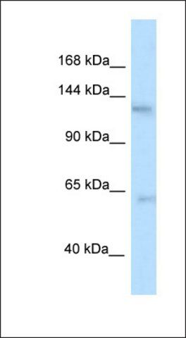 Anti-TTBK2 antibody produced in rabbit