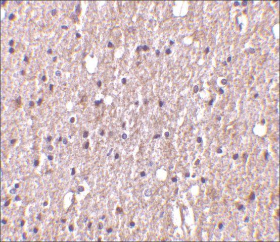 Anti-TWEAK antibody produced in rabbit