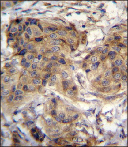 ANTI-TTC9C (N-TERM) antibody produced in rabbit