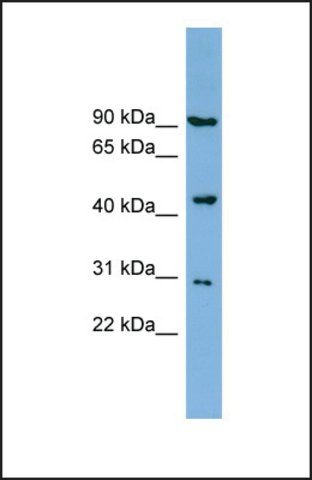 Anti-TUSC4 antibody produced in rabbit