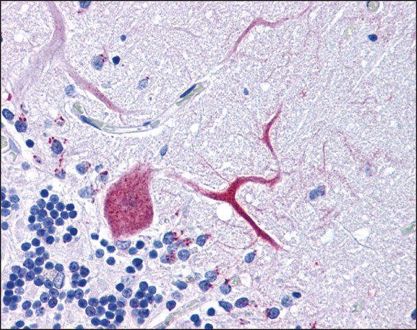 Anti-TTBK1 antibody produced in rabbit