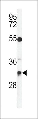 ANTI-TSPAN7 (CENTER) antibody produced in rabbit