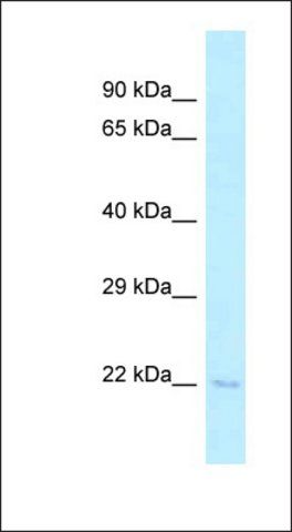 Anti-TSEN15 antibody produced in rabbit