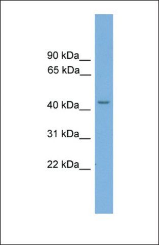 Anti-TSPYL6, (N-terminal) antibody produced in rabbit