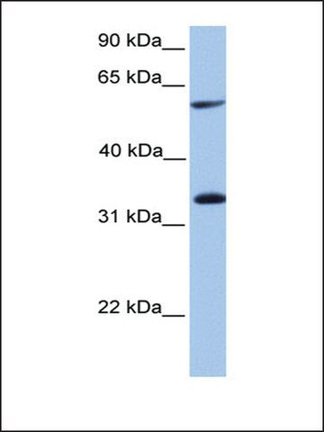 Anti-TSKS (AB2) antibody produced in rabbit